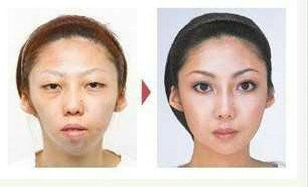 �й�����������̫�� ������Ϸ�ͥ����75��