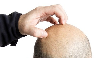 为什么感到痒的时候要挠