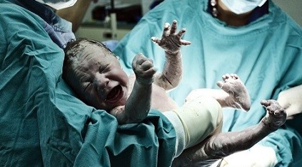 经济利益促使医生实施剖腹产