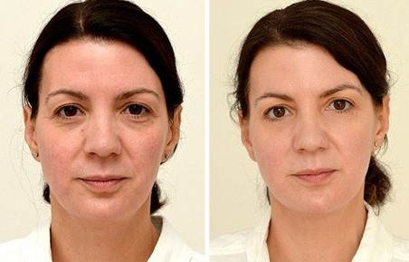 英国女记者:日饮3升水 4周年轻10岁