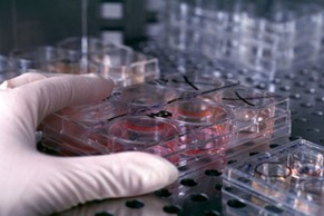 经济学人下载:胚胎干细胞 进展中的干细胞研究
