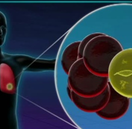 Gene Tests May Improve Lung Cancer Care