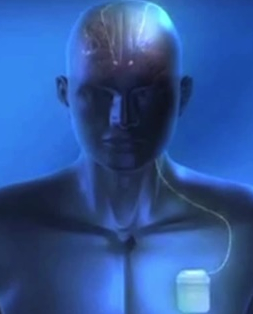<a href=http://www.hxen.com target=_blank class=infotextkey>study</a>: Electric Brain Stimulation Alleviates Some Disorders